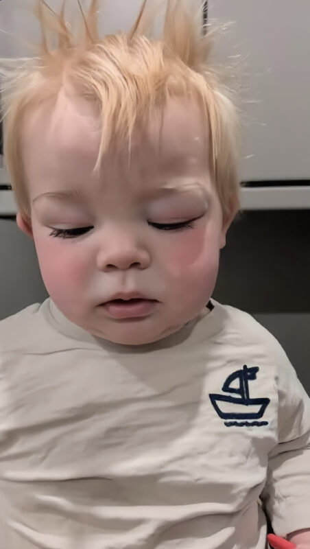 Als mein Baby geboren wurde, blieb eines seiner Augen geschlossen. Zunächst schien alles wieder in Ordnung zu sein, doch einige Monate später trat die Schwellung erneut auf. Dann stellten die Ärzte eine erschütternde Diagnose, die unser Leben für immer veränderte...