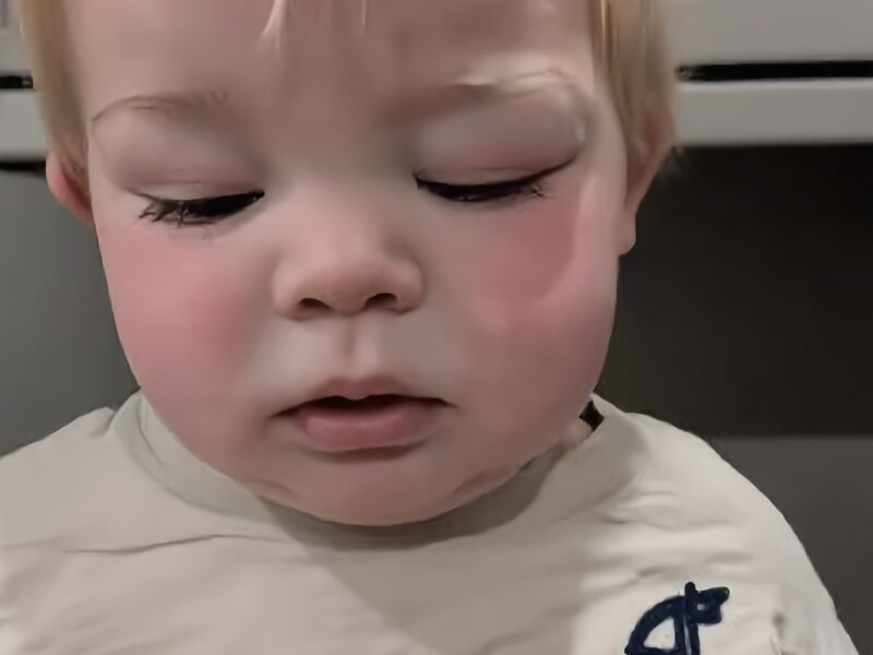 Als mein Baby geboren wurde, blieb eines seiner Augen geschlossen. Zunächst schien alles wieder in Ordnung zu sein, doch einige Monate später trat die Schwellung erneut auf. Dann stellten die Ärzte eine erschütternde Diagnose, die unser Leben für immer veränderte...
